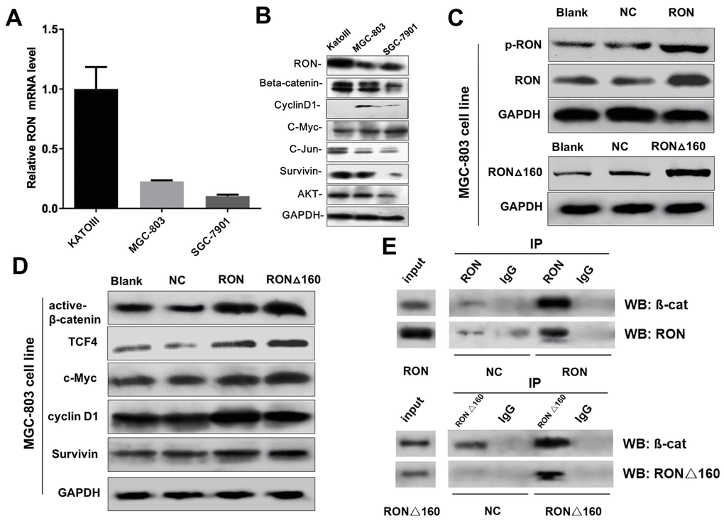 Effects of RON/RONΔ160 on the activation of β-catenin signaling in human gastric cancer cell lines. (A) Relative mRNA levels of RON and β-catenin signaling-related genes detected in human gastric cancer cell lines using qPCR. (B) Western blots showing RON, β-catenin, TCF4, c-Myc, Cyclin D1, and survivin in three gastric cancer cell lines. (C) Transfection efficiency of RON and RONΔ160 in MGC-803 cells. (D) Expression of β-catenin signaling-related genes after transfection of RON or RONΔ160 into MGC-803 cells. (E) Interaction of RON/RONΔ160 and β-catenin in MGC-803 cells determined using co‑immunoprecipitation assays. ** p