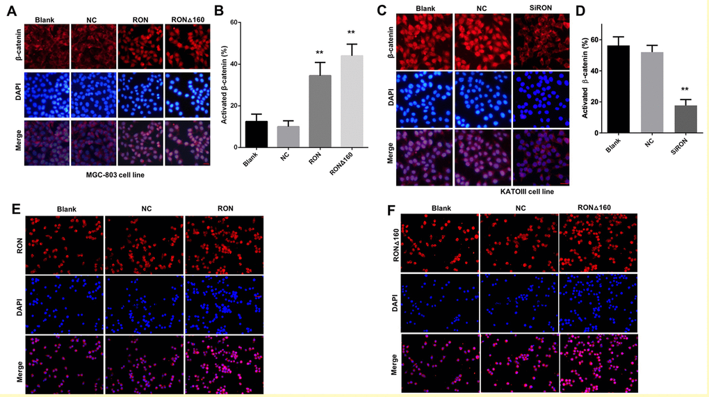 Role of RON/RONΔ160 in the activation and nuclear translocation of β-catenin. (A) MGC-803 cells were transfected with RON and RONΔ160 and immunostained for RON and β-catenin. (B) Nuclear translocation ratio of β-catenin in different groups of MGC-803 cells. (C) Immunostaining for RON and β-catenin in KATOIII cells transfected with siRNA targeting RON. (D) Nuclear translocation ratio of β-catenin in different groups of KATOIII cells. (E) and (F) MGC-803 cells were transfected with RON or RONΔ160 and immunostained for RON or RONΔ160. ** p
