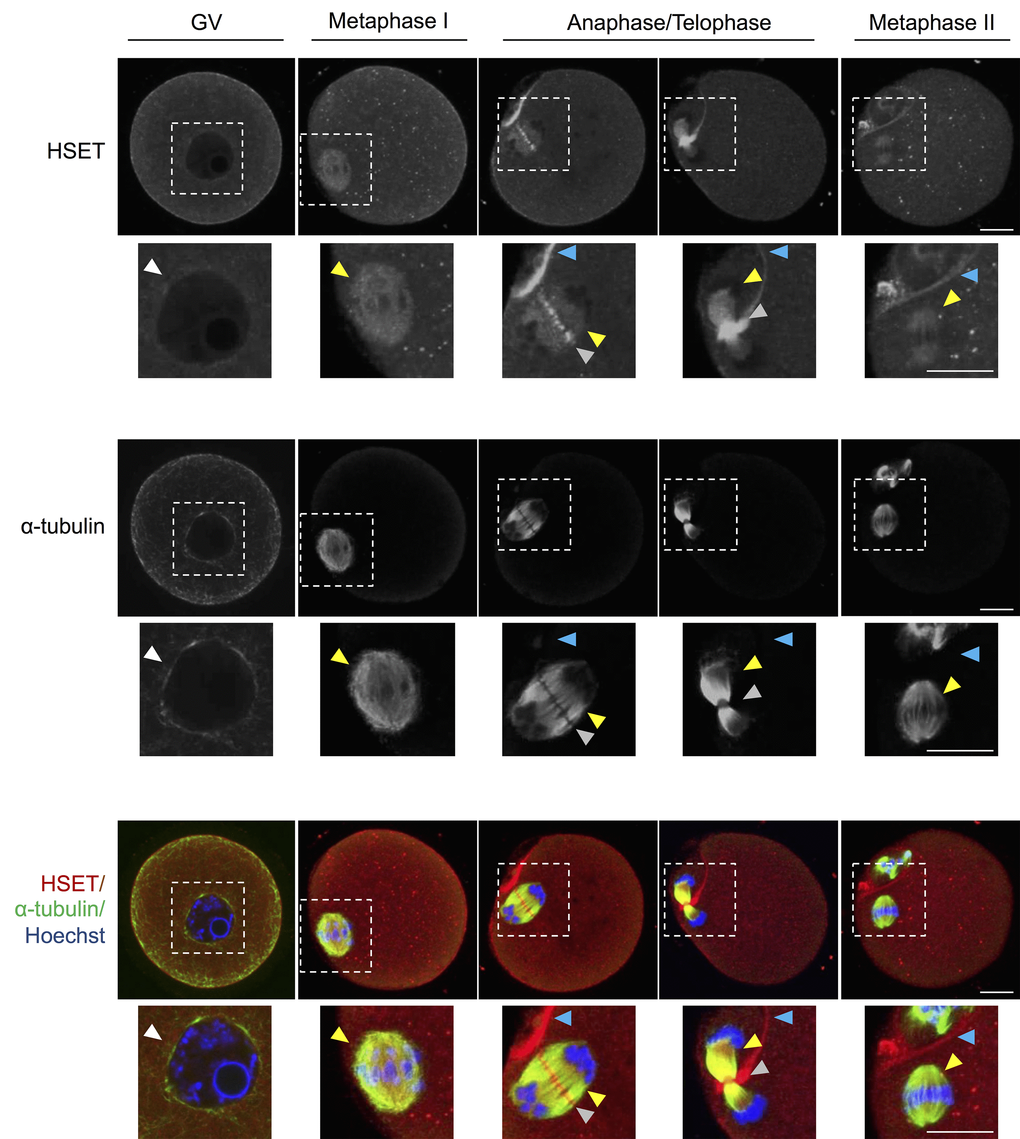 HSET expression throughout oocyte meiosis. Immunofluorescence analysis was utilized to track the spatial profile of HSET distribution in GV, MI, anaphase I/telophase I, and MII stage oocytes. Inserts highlight the localization of HSET to the nuclear envelope (white arrowheads), microtubules (yellow arrowheads), between the chromosomes (grey arrowheads), and at the partitioning of the polar body (blue arrowheads). Oocytes were dual labelled with anti-HSET and anti-α-tubulin antibodies followed by either appropriate goat anti-rabbit 633 Alexa Fluor (red) or goat anti-mouse 488 Alexa Fluor-conjugated (green) secondary antibodies, respectively. Oocytes were then counterstained with the nuclear stain Hoechst 33342 (blue) and viewed using confocal microscopy. Scale bar = 20 μm. These experiments were repeated using three independent biological replicates, with each comprising a minimum of 10 oocytes, and representative images are shown.