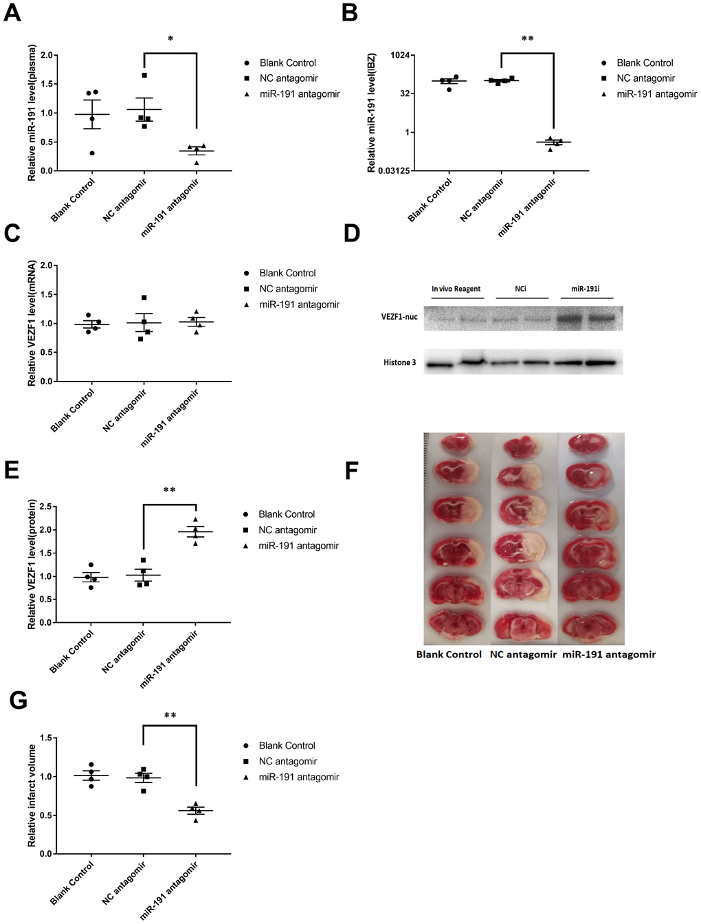 Inhibition of miR-191 reduced infarction volume of MCAO rats after the injection of miR-191 antagomir compared to NC antagomir and blank control. Relative miR-191 levels in (A) plasma and (B) IBZ (n =4 per group); (C) Real-time PCR analysis of VEZF1 expression in IBZ (n =4 per group); (D, E) Western blot analysis of VEZF1 expression in IBZ (n =4 per group); (F, G) Relative infarct volume of MCAO rats (n =4 per group). Means ± SEM. * P