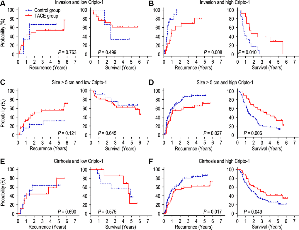 combination of Cripto-1 and tumor features predicts response to postoperative TACE. All patients were divided according to Cripto-1 levels within vascular invasion (A, B), lager tumor size (C, D) or liver cirrhosis (E, F). Kaplan-Meier survival estimates and log-rank tests were used to analyze the correlation of adjuvant TACE therapy and OS/TTR in different subgroups.