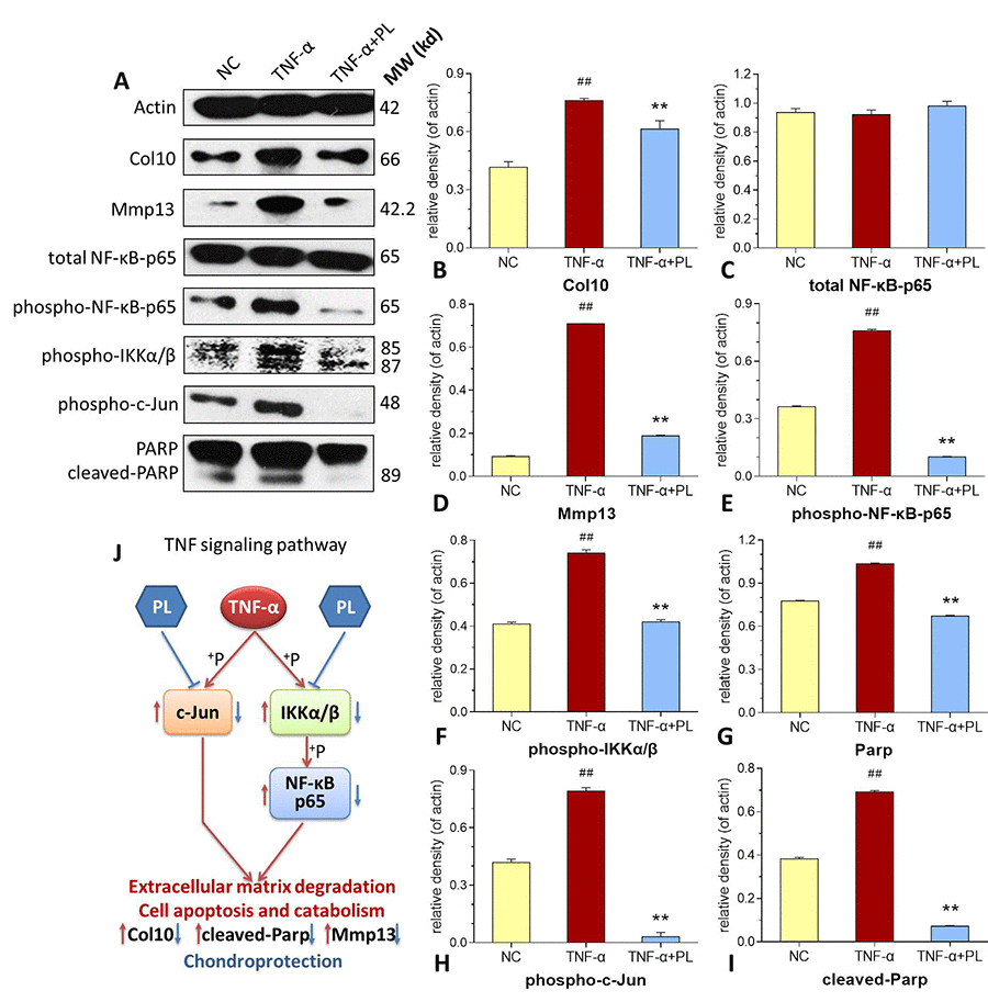 (A–I) Expression and phosphorylation of target proteins in chondrocytes. (A) electrophoretic profile; (B) Col10 expression; (C) total NF-κB-p65 expression; (D) Mmp13 expression; (E) phospho-NF-κB-p65 expression; (F) phosphor-IKKα/β expression; (G) PARP expression; (H) phosphor-c-Jun expression; (I) cleaved-PARP expression. (J) deduced process of relative TNF signaling pathway. Values are shown as mean ± SD. ##P P P 
