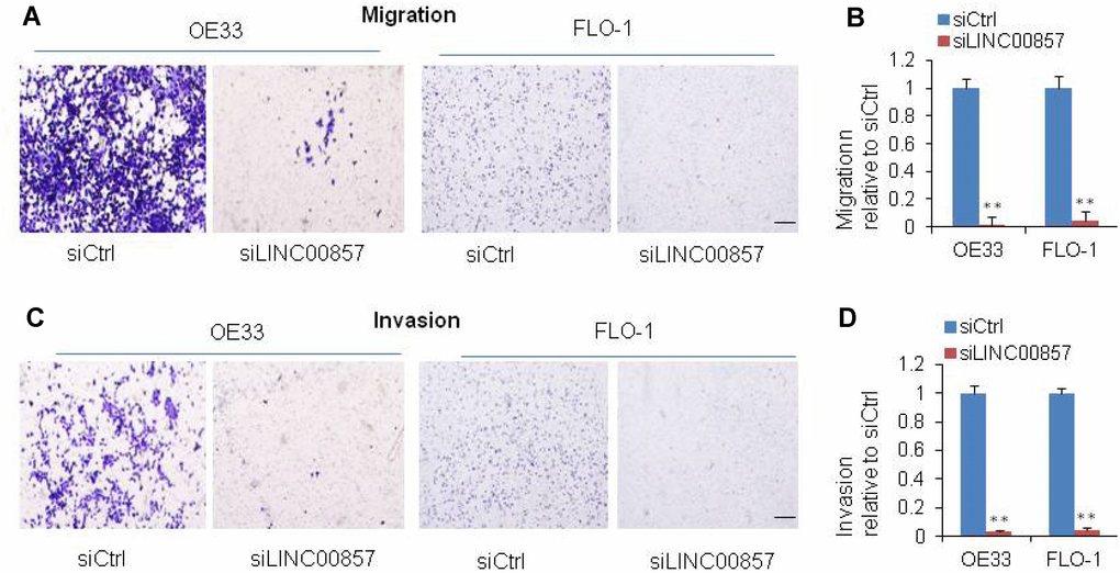 SiRNA-mediated knockdown of LINC00857 inhibits EAC cell migration and invasion. (A) Migration was decreased after LINC00857 siRNA transfection of OE33 and FLO1 cells. (B) The bar chart represented the count number of migration cells. (C) Invasion was decreased after LINC00857 siRNA transfection of OE33 and FLO1 cells. (D) The bar chart represented the count number of invasion cells. Values represented the mean ± s.d. from three independent experiments. *p 