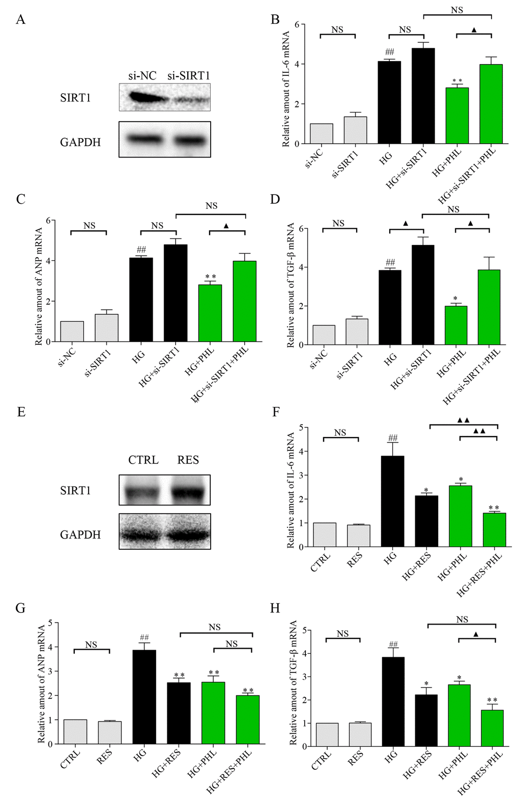 Knockdown of SIRT1 aggravate HG induced inflammation, hypertrophy and fibrosis mRNA level in H9C2 cells. (A) Knockdown of SIRT1 expression by siRNA in H9C2 cells. Assessment of SIRT1 protein levels was performed 48 h following transfection. (B-D) Real-time qPCR assay showed the mRNA levels of IL-6 (B), ANP (C), and TGF-β (D) in negative control (NC) or SIRT1 siRNA transfected H9C2 cells treated with HG. H9C2 cells pre-treated with PHL (20 μM) for 1 h were stimulated by HG (33 mM). (E) Overexpression of SIRT1 expression by RES (50 μM) in H9C2 cells. Assessment of SIRT1 protein levels was performed 24 h after treatment for RES. (F-H) H9C2 cells pre-treated with RES, PHL or RES+PHL for 1 h were stimulated by HG (33 mM). Real-time qPCR assay showed the mRNA levels of IL-6 (F), ANP (G), and TGF-β (H). Data are presented as means ± SEM. *P ##P ▲P ▲▲P 
