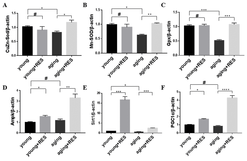 Resveratrol treatment activated the antioxidant system and Ampk/Sirt1/Pgc1α pathway in aging zebrafish retina. (A-F) Cu/Zn-Sod, Mn-Sod, Gpx, Ampk, Sirt1, and Pgc1α expression in young, resveratrol-treated young, aging, and resveratrol-treated aging zebrafish retinas. Graphs represent (A) Cu/Zn-Sod, (B) Mn-Sod, (C) Gpx, (D) Ampk, (E) Sirt1, and (F) Pgc1α gene expression by quantitative real-time PCR (mean ± SEM, *P