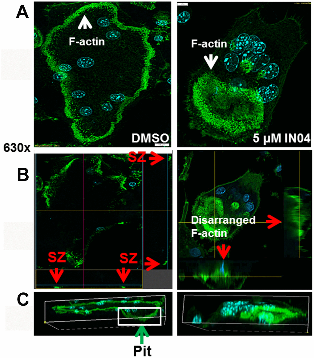 IN04 treatment disrupts the cytoskeleton arrangement and F-actin ring formation of osteoclasts. Osteoclast precursors derived from C57BL/6J mice were seeded on bone slices and differentiated in the presence of DMSO or INO4 for 6–9 days. Mature osteoclasts were stained with Alexa Fluor 488-conjugated phalloidin and DAPI, and the actin ring formation and sealing zone were visualized by confocal microscopy. (A) Representative images of IN04- and DMSO-treated osteoclasts. (B) Horizontal cross sections of selected osteoclasts. Two lines in the middle of the cell represent positions of horizontal and vertical cuts, respectively. Rectangles are orthogonal views of X- and Y-sections, respectively. Arrows in red indicate sealing zones (SZ). (C) 3D rendering of a lateral view. A DMSO-treated osteoclast was invaded in a resorptive pit indicated by an arrow in green while an IN04-treated cell was on the surface of the bone slice.