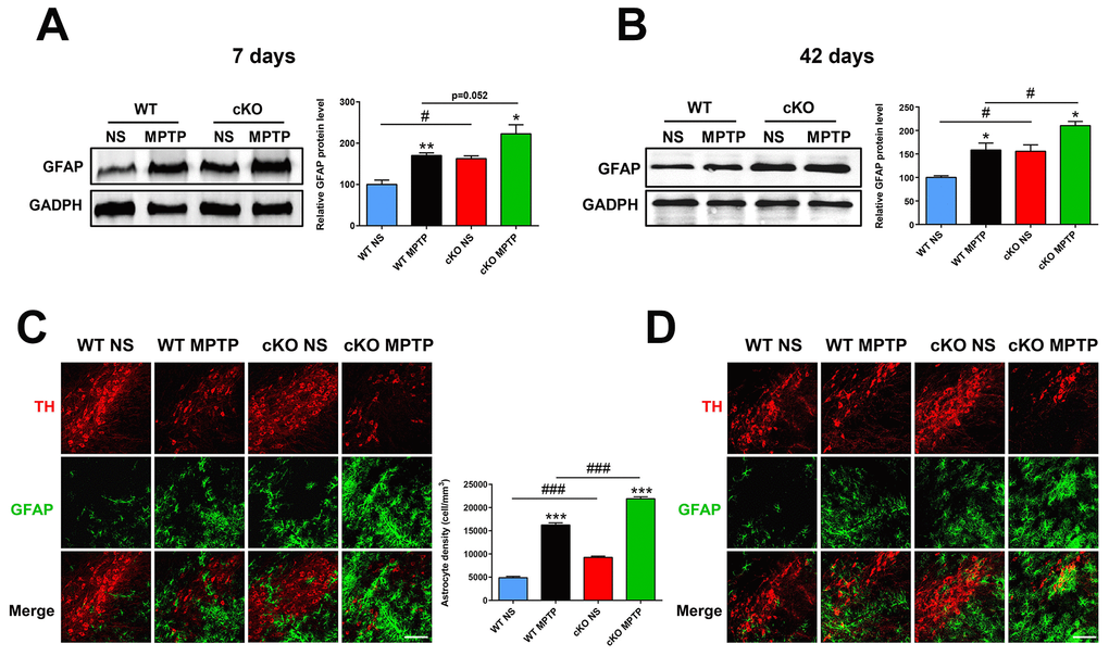 NRSF deficiency correlates with increased astrocyte activation in the nigrostriatal pathways after MPTP administration. (A) Western blot analysis of striatal GFAP at 7 days after saline or MPTP administration. Quantification of GFAP expression is shown in the right panel. N = 5. (B) Immunofluorescence staining of GFAP (green) and TH (red) in the substantia nigra at 7 days after saline or MPTP administration. Scale bar: 100 μm. Statistics for GFAP-positive cells are shown in the right panel. N = 4. (C) Western blot analysis of striatal GFAP at 42 days after saline or MPTP administration. Quantification of relative GFAP expression is shown in the right panel. N = 4. (D) Immunofluorescence staining of GFAP (green) and TH (red) in the substantia nigra at 42 days after saline or MPTP administration. Scale bar: 100 μm. Data are means ± SEM. Data were analyzed by one-way ANOVA. *P p p p p 