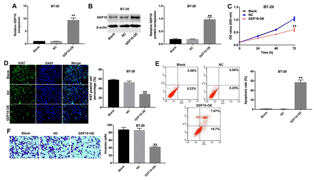 Overexpression of GDF10 inhibits proliferation of BT-20 cells. GDF10 expression at the mRNA (A) and protein (B) levels in BT-20 cells 72 h after transfection with NC or GDF10 for 72 h. **P C) Cell proliferation assay results. BT-20 were transfected with NC or GDF10 and the CCK-8 assay was conducted at 0, 24, 48, and 72 h. **P D) Ki67 immunofluorescence quantification in NC and GDF10-overexpressing BT-20 cells. **P E) Apoptosis rates detected through Annexin V/PI double staining and flow cytometry in NC and GDF10-overexpressing BT-20 cells. **P F) Cell invasion assay. BT-20 cells were transfected with NC or GDF10 for 72 h and Matrigel-coated transwell inserts used to quantify their invasive capacity. **P 