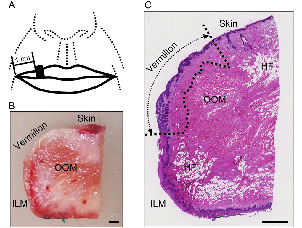 Areas used for investigation. (A) Specimen collection site: the black square indicates the site of specimen collection. (B) Representative image of a dissected specimen: the skin surface and intraoral labial mucosa on the oral cavity side were stained with red and green pigments, respectively. Bar=1 mm; OOM, orbicularis oris muscle; ILM, intraoral labial mucosa. (C) Representative image of hematoxylin and eosin stained section of upper lip: the boundary of the vermilion is indicated by the dotted line. Bar=1 mm; OOM, orbicularis oris muscle; HF, hypodermal fat; ILM, intraoral labial mucosa. Note: Hypodermal fat in the vermilion was absent from all specimens.
