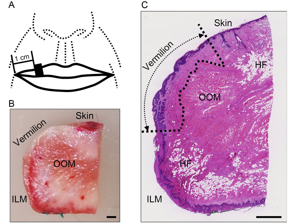 Age related changes in the vasculature of the dermis of the upper