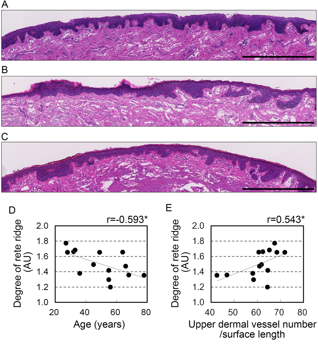 Development of rete ridges correlates with age and vascular condition in the upper dermis. (A-C) Representative images from hematoxylin and eosin staining in the upper dermis of 28 (A), 45 (B), and 68 (C) year old donors. Bar=500 μm. (D, E) Rete ridge elongation plotted against (D) age and (E) number of blood vessels in the upper dermis per surface length. n=14. *p