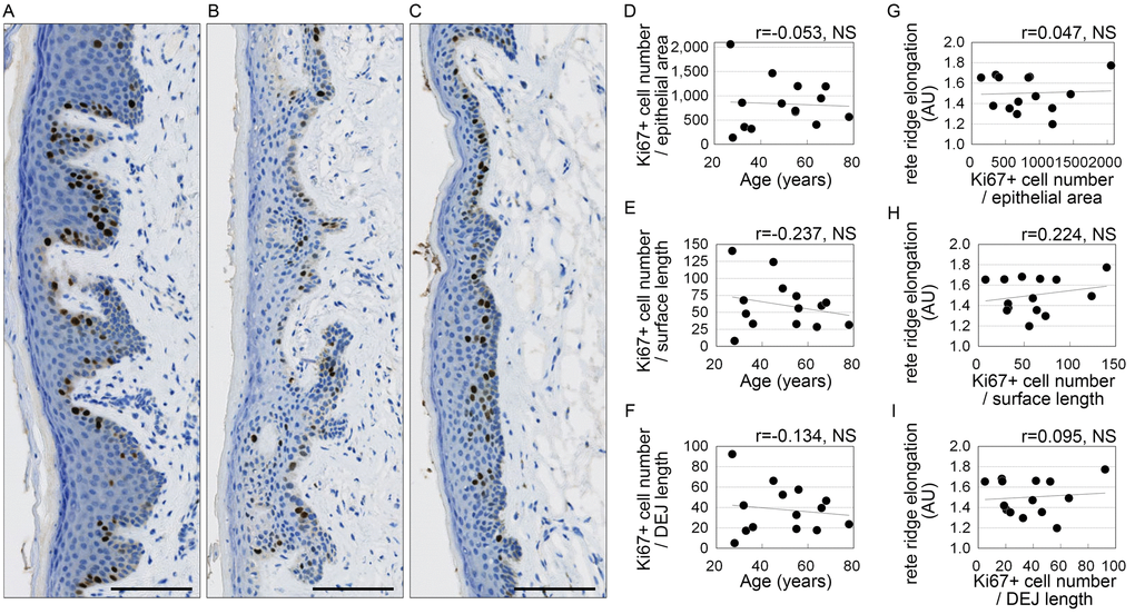Squamous epithelial cell proliferation of does not correlate with age or rete ridge elongation. (A-C) Representative images of Ki67 staining. Donors were 32 (A), 49 (B), and 78 (C) years old. Bar=100 μm; brown, Ki67+ cells; blue, cell nuclei. (D-I) Numbers of Ki67-positive cells plotted against age (D-F) or rete ridge elongation (G-I). (D, G) Numbers of Ki67-positive cells per area of stratified squamous epithelium area (number/mm2). (E, H) Numbers of Ki67+ cells per surface length (number/mm). (F, I) Numbers of Ki67+ cells per length of the dermo-epithelial junction (DEJ) (number/mm). n=14; NS, not significant (Pearson's correlation test).