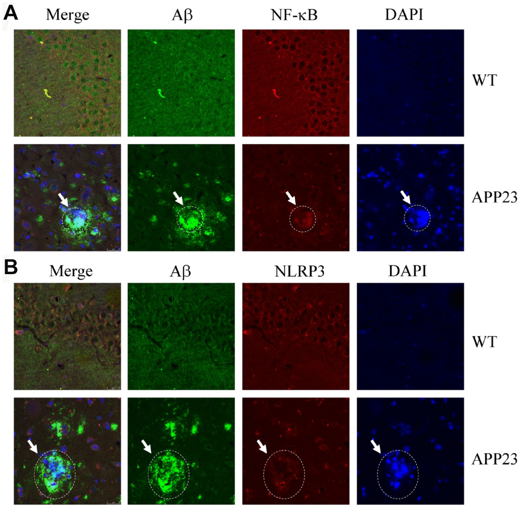 Confocal fluorescence microscopy shows colocalization of NF-κB, NLRP3, and Aβ42 in the brains of APP23 mice. Images from a single z-plane of the brains of APP23 mice at 6 months of age using monoclonal antibodies against Aβ (green), NF-κB/NLRP3 (red), and nucleus (blue DAPI stain). (A) Colocalization of NF-κB and Aβ42 is observed as indicated in the circle. (B) Colocalization of NLRP3 and Aβ42 was observed as indicated in the circle. Scale bar=25 μm.