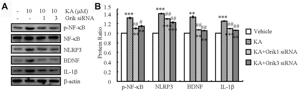Grik1 and Grik3 mediate the KA-induced phosphorylation of NF-κB and the expression of NLRP3, IL-1β, and BDNF. Grik1 and Grik3 siRNAs (200 ng) were transfected to BV2 cells before treatment with KA (10 μM) (N=3). (A) Phosphorylation levels of NF-κB and expression levels of NLRP3, IL-1β, and BDNF were determined by Western blotting in KA and/or Grik1/3 transfected BV2 cells. (B) The optical density of bands in Western blotting was analyzed by ImageJ software **P***P#P##P
