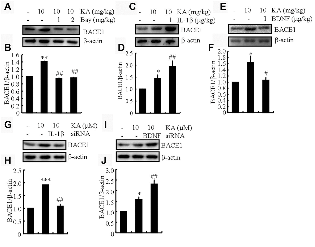 IL-1β shows addictive effects whereas BDNF shows antagonistic effects of KA on inducing the expression of BACE1. (A and B) Protein levels of BACE1 in the brains of KA (10 mg/kg)- or Bay11-7082 (1 or 2 mg/kg)+KA-treated APP23 mice (N=6). (C and D) Protein levels of BACE1 in the brains of KA- or IL-1β (1 μg/kg)+KA-treated APP23 mice (N=6). (E and F) Protein levels of BACE1 in the brains of KA- or BDNF (1 μg/kg)+KA-treated APP23 mice (N=6). (G and H) IL-1β and (I and J) BDNF were knocked down in the BV2 cells and the conditional medium was collected for the incubation of N2a cells. Protein levels of BACE1 were determined by Western blotting (N=3). The optical density of bands in Western blotting was analyzed by ImageJ software *P**P***P#P##P