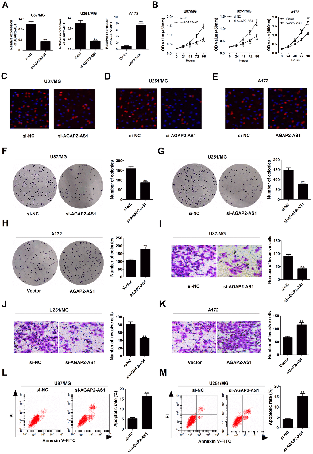 Silencing of AGAP2-AS1 represses proliferation and invasion, and promoted apoptosis in GBM cells. U87/MG and U251/MG cells were transfected with si-NC or si-AGAP2-AS1, while A172 cells were introduced with empty vector or pcDNA-AGAP2-AS1. (A) qRT-PCR analysis of transfection efficiency in U87/MG, U251/MG and A172 cells. (B) CCK-8 analysis was conducted to detect the viability in transfected U87/MG, U251/MG and A172 cells. (C–E) (d) EdU staining assay was performed to evaluate the proliferation ability in transfected U87/MG, U251/MG and A172 cells. Red, EdU staining for dividing cell; blue, DAPI staining for nuclear. (F–H) Colony-forming assay was used to examine the cloning ability in transfected U87/MG, U251/MG and A172 cells. (I–K) Transwell assay was carried out to assess the invasiveness in transfected U87/MG, U251/MG and A172 cells. (L and M) Flow cytometry analysis was applied to determine the apoptotic rate in transfected U87/MG, U251/MG and A172 cells. *P **P 