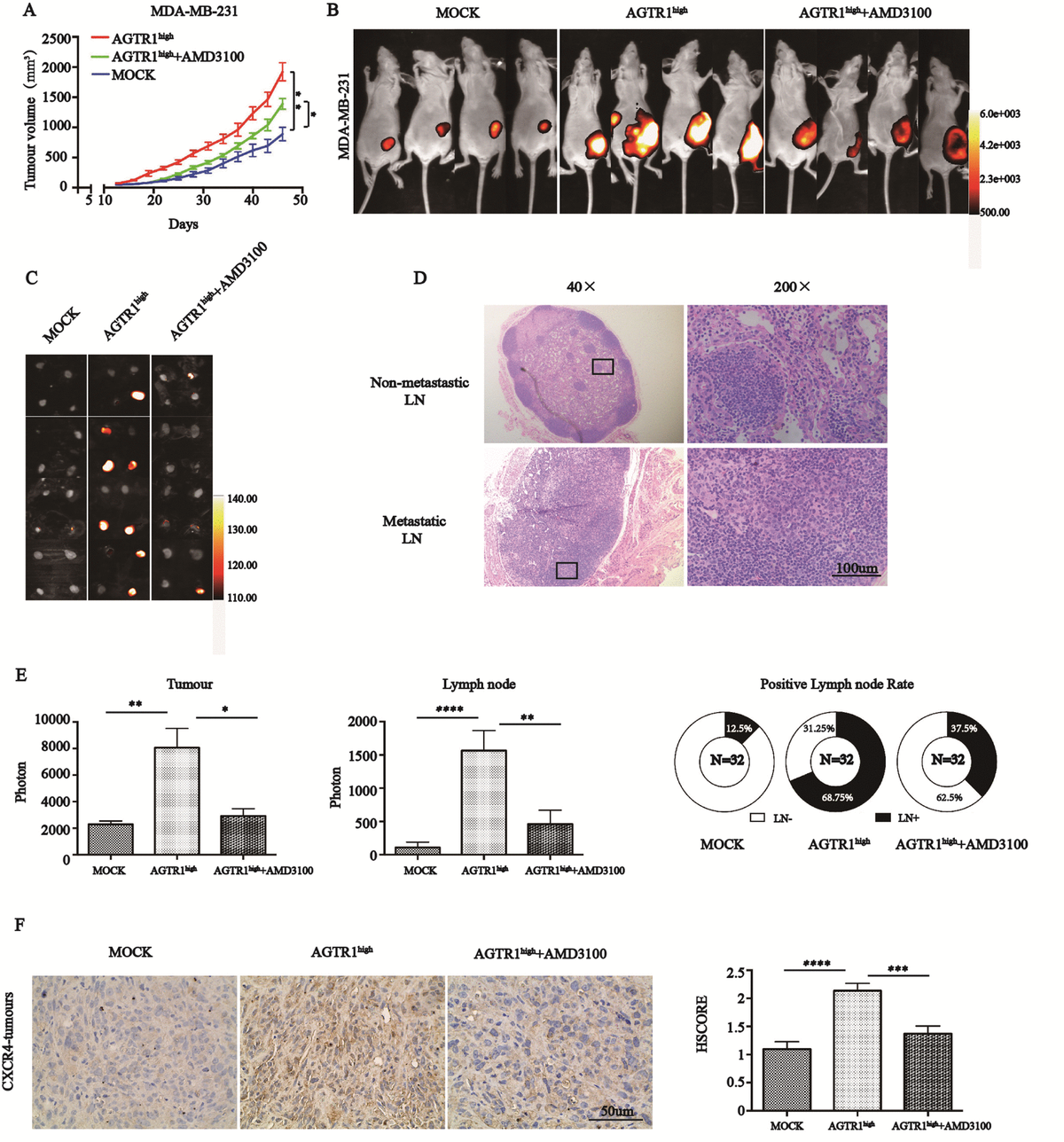 Agtr1 Promotes Lymph Node Metastasis In Breast Cancer By Upregulating