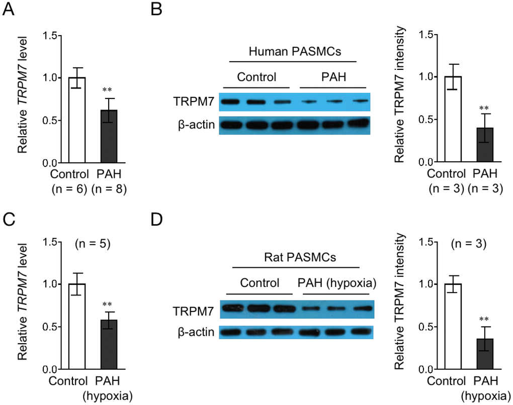 TRPM7 expression is downregulated in PASMCs from PAH human and a rat model. (A) The mRNA level of TRPM7 in PASMCs from control (n = 6) or PAH (n = 8) human donors was determined by qRT-PCR analysis. β-actin was used as a reference control. Data are mean ± SD. Unpaired Student’s t-test. **, P B) The protein level of TRPM7 in PASMCs from 3 representative control and PAH human donors was determined by Western blot analysis. β-actin was used as a loading control. The representative images (left) and band intensity analysis (right) are shown. Data are mean ± SD. Unpaired Student’s t-test. **, P C) The mRNA level of TRPM7 in PASMCs from control (n = 5) or hypoxia-induced PAH (n = 5) rats was determined by qRT-PCR analysis. β-actin was used as a reference control. Data are mean ± SD. Unpaired Student’s t-test. **, P D) The protein level of TRPM7 in PASMCs from 3 representative control and hypoxia-induced PAH rats was determined by Western blot analysis. β-actin was used as a loading control. The representative images (left) and band intensity analysis (right) are shown. Data are mean ± SD. Unpaired Student’s t-test. **, P 