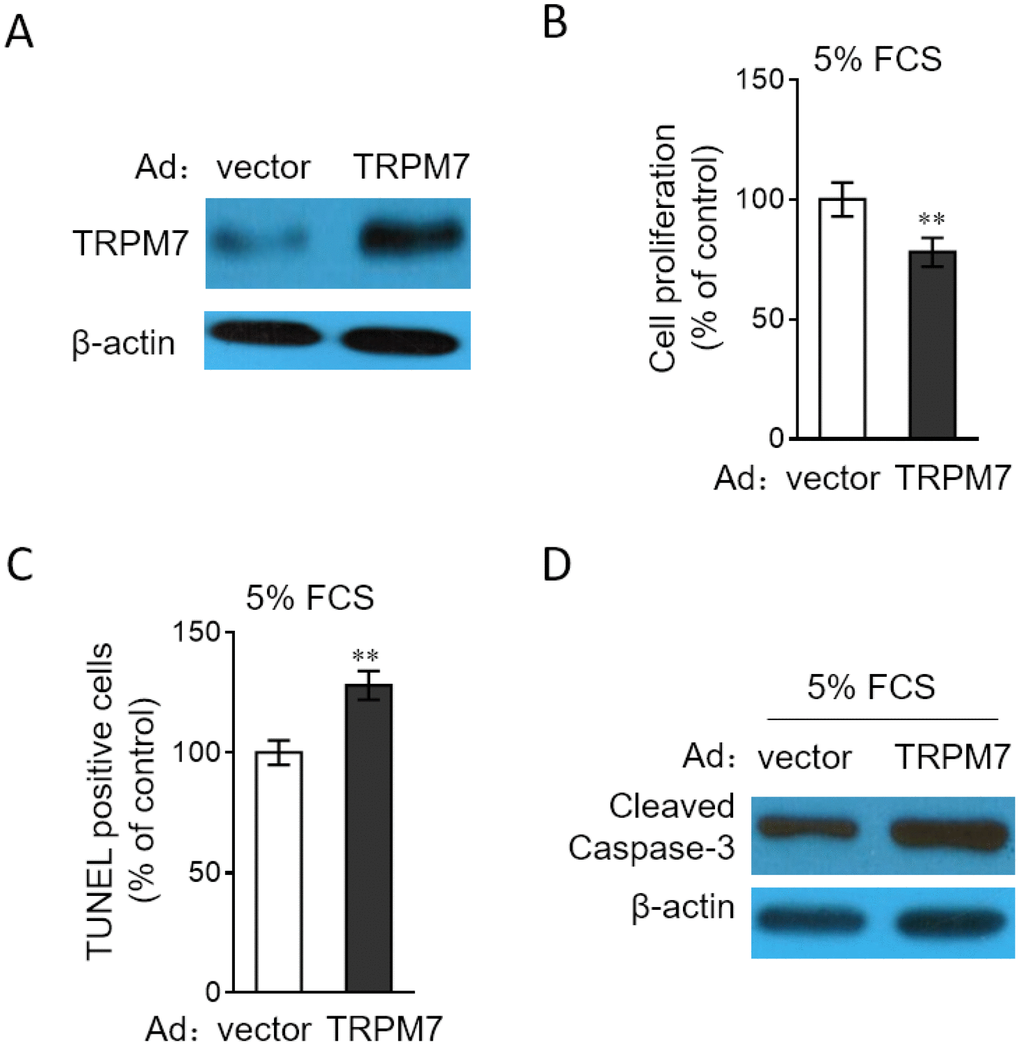 TRPM7 overexpression reverses proliferation and apoptosis resistance in PASMCs. (A) PASMCs from rats were infected with adenovirus expressing control vector (Ad-Ctrl) or TRPM7 (Ad-TRPM7). After 72 h of infection, the protein level of TRPM7 was determined by Western blot analysis. β-actin was used as a loading control. The representative images from 3 independent experiments are shown. (B–D) PASMCs from rats were infected with Ad-Ctrl or Ad-TRPM7. After 24 h of infection, cells were serum starved for 24 h, followed by incubation with medium containing 5% FCS for another 24 h. (B) Cell proliferation was determined by BrdU incorporation assay. (C) Cell apoptosis was detected by TUNEL staining. Results are expressed as a percentage relative to control. Data are mean ± SD. n = 3. One-way ANOVA test. **, P D) The protein expression of cleaved caspase-3 was determined by Western blot analysis. β-actin was used as a loading control. The representative images from 3 independent experiments are shown.