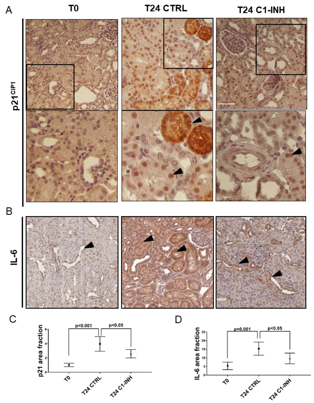 p21 and IL-6 are induced in tubular cells after I/R and modulated by C1-INH treatment. (A) Representative micrographs indicating p21/CIP1 protein expression in different groups of swine after I/R injury, as indicated. Boxed areas are enlarged at the bottom of each micrographs. Compared to T0, biopsies after 24h from reperfusion (T24 CTRL) showed increased nuclear (black arrow) and cytoplasmic staining (white dotted arrow). C1-INH treatment restored p21 at basal expression; limiting the cytoplasmic p21 expression. (B) Representative micrographs show the expression and localization of IL-6, a marker of SASP in T0 (right), T24 CTRL (middle) and T24 C1-INH (right) groups. Arrows indicate positive tubular cells. Compared to T0, biopsies after 24h from reperfusion (T24 CTRL) showed increased IL-6 expression, predominantly at tubular cells. Treatment with C1-INH counteracts IL-6 increase. (C, D) Graphical representation of p21 and IL-6 area fraction in the different groups. (n=5, p value as indicated).