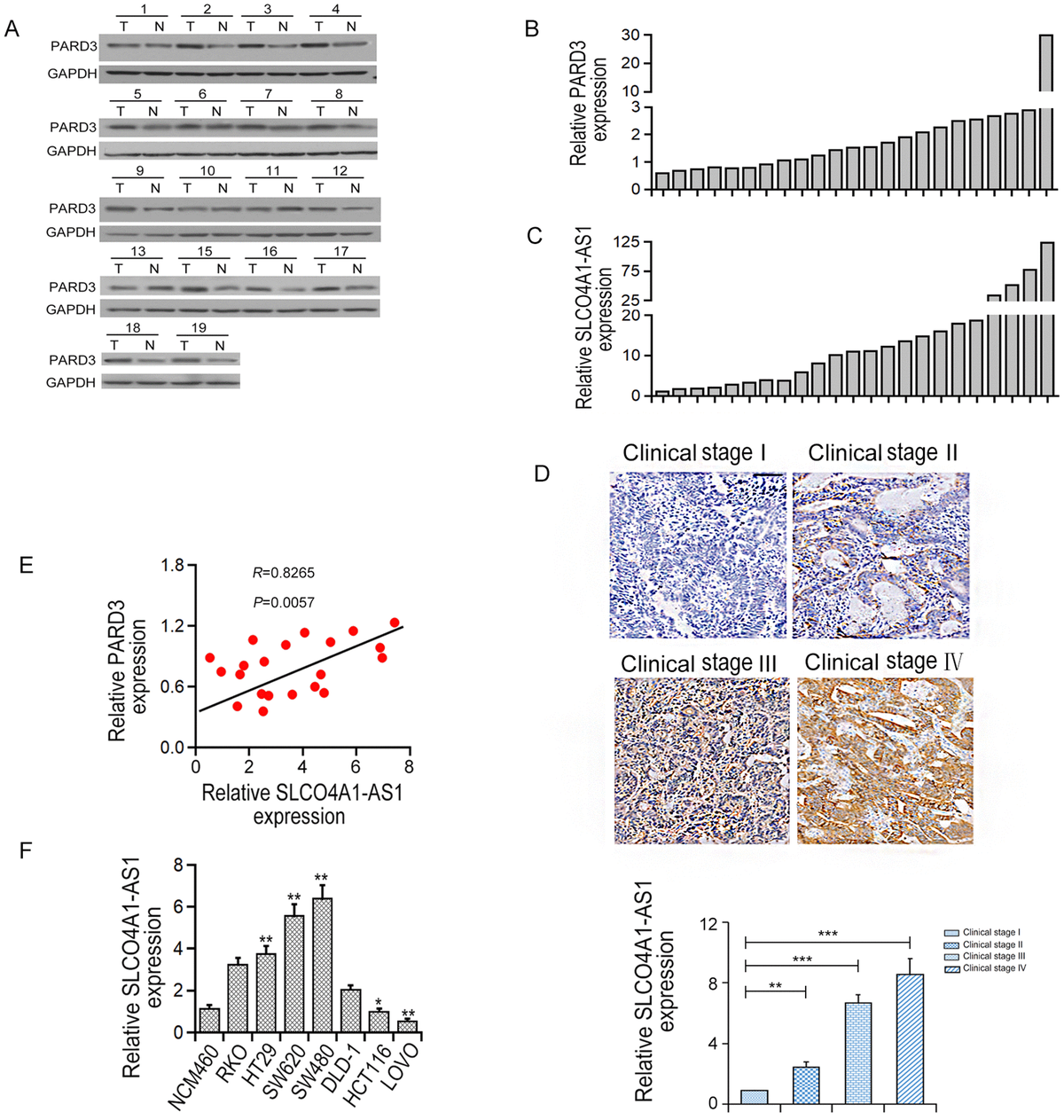 LncRNA SLCO4A1-AS1 promotes colorectal cancer cell proliferation by ...