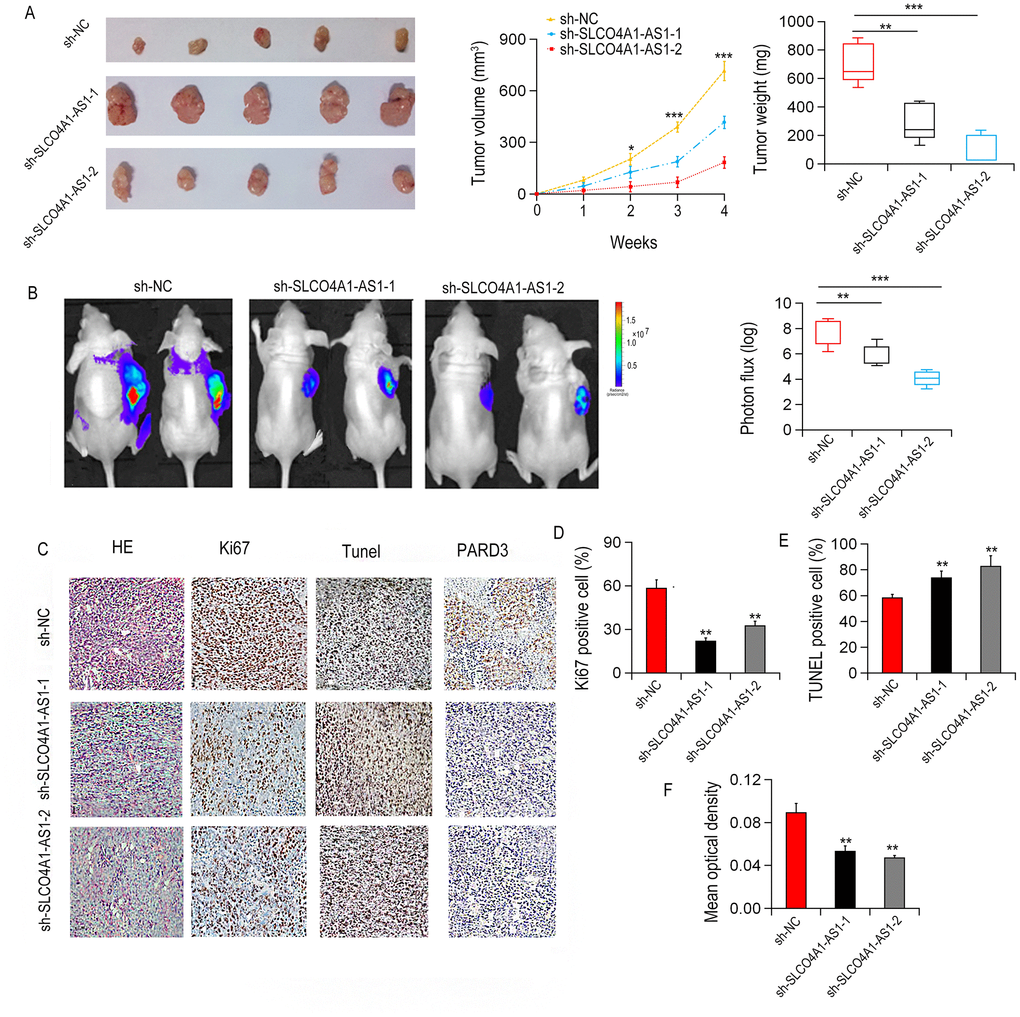 SLCO4A1-AS1 knockdown inhibited CRC growth in xenograft nude mice. (A) Tumor weight and volumes in xenograft nude mice (n = 5) after subcutaneous injection withSW620-sh-SLCO4A1-AS1 or SW620-sh-NC cells. (B) Representative images and photon influx of xenograft tumors in mice after subcutaneous injection with SW620-SLCO4A1-AS1 or SW620-sh-NC cells. (C–F) Representative images of H&E staining, Ki67, TUNEL, and PARD3. *P 