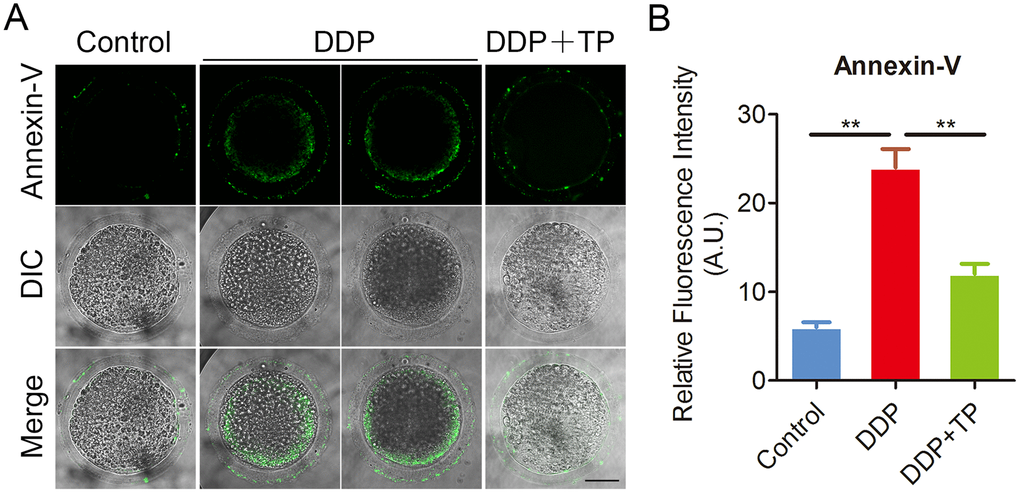 Effects of TP on early apoptosis in DDP-exposed porcine oocytes. (A) Representative images of apoptotic oocytes in control, DDP-exposed and TP -supplemented groups. Scale bar, 35 μm. (B) The rate of early apoptosis was recorded in control, DDP-exposed and TP-supplemented oocytes. Data in (B) were presented as mean percentage (mean ± SEM) of at least three independent experiments. **P 