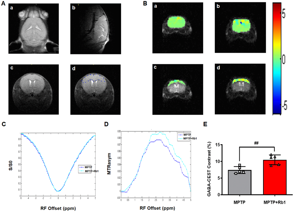 Rb1 increases GABA level in the PFC in MPTP-treated mice. (A-a, b, and c) Three different imaging orientations of the structural scans of the mouse brain. (A-d) The regions of interest (ROIs) in a brain slice positioned in the transverse plane to access the maximum of the PFC. GABA-CEST, B0, and B1 maps were also acquired from this slice (thickness = 3 mm). (B) The top two panels show GABA-CEST maps of the whole brain in (a) the MPTP group and (b) the MPTP+Rb1 group. The bottom two panels show GABA-CEST maps of the ROIs in the PFC of (c) the MPTP group and (d) the MPTP+Rb1 treatment group. (C and D) Superimposed maps of the Z-spectrum and magnetization transfer ratio asymmetry (MTRasym) spectrum between the MPTP group and the MPTP+Rb1 treatment group. (E) Quantification of GABA level in the PFC of the MPTP group and the MPTP+Rb1 treatment group. n = 5 per group. Results are expressed as the mean ± SEM. ##P t-test.
