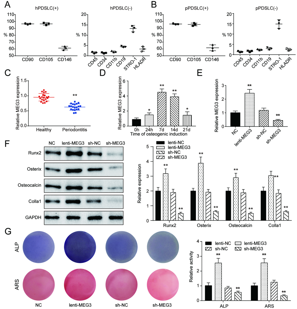 Establishment of co-expression network and identification of PDLSCs and lncRNA MEG3 was positively related with PDLSC osteogenic differentiation. (A) Expression of hPDLSC surface antigens including CD90, CD105, CD146, CD45, CD34, CD11b, CD19, STRO-1, and HLADR. (B) Expression of pPDLSC surface antigens including CD90, CD105, CD146, CD45, CD34, CD11b, CD19, STRO-1, and HLADR. (C) MEG3 was down-regulated in periodontitis tissues compared with heathy samples. (D) Expression of MEG3 mRNA in 0h, 24h, 7d, 14d and 21d after osteogenic induction. (E) Expression of MEG3 mRNA in PDLSCs treated with or without lenti-MEG3, sh-NC or sh-MEG3. (F) Western blot of osteoblast makers including Runx2, Osterix, Osteocalcin and Colla1. (G) ALP and Alizarin Red staining of PDLSCs treated with or without lenti-MEG3, sh-NC or sh-MEG3. ** P P 