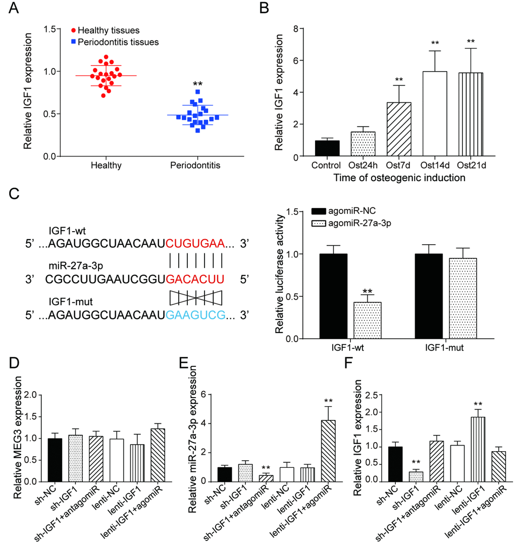 LncRNA MEG3 was correlated to IGF1 via MiR-27a-3p. (A) IGF1 expression in periodontitis periodontal tissues compared with healthy periodontal tissues. (B) Expression of IGF1 in 0h, 24h, 7d, 14d and 21d after osteogenic induction. (C) MiR-27a-3p directly targeted IGF1. (D–F) Expression of MEG3, miR-27a-3p and IGF1 in PDLSCs of each group. ** P 
