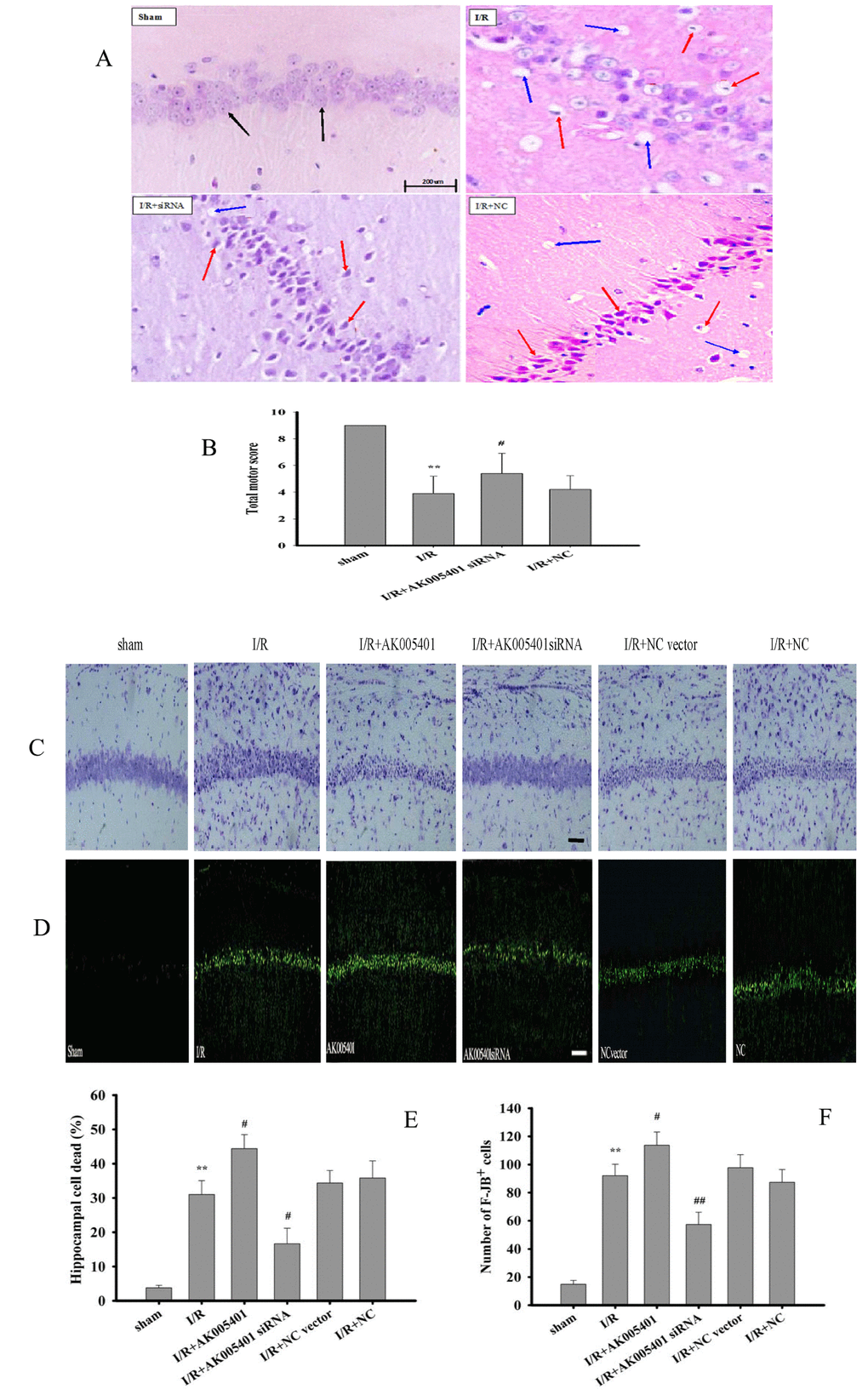 Effect of AK005401on ischemia/reperfusion (I/R) induced mice hippocampus pathomorphology and motor score. The mice were divided into four groups: sham, I/R, AKsiRNA, and NC. In addition, AK005401 overexpression vector group and NC vector group were added. After reperfusion for 24 hours, the motor score of each mouse was obtained according to the neurological test method. The brains were fixed, embedded in paraffin, cut into 4-μm-thick sections, and stained with HE, cresyl violet and FJB. (A) The neurons in the CA1 hippocampus stained with HE were observed by light microscopy. Light microscopy shows normal neuronal cells (black solid line arrows), pathological neurons with shrunken cytoplasm, damaged nuclei (red solid line arrows), and vacuolization (blue solid line arrows). (B) Total motor scores in all groups were showed (n = 15). (C) The neurons stained with cresyl violet were observed by light microscopy. (D) The neurons stained with FJB were observed by light microscopy. (E) The percentage of cell deaths was analyzed (n=3). (F) F-JB+ cells were counted (n=3). Data were presented as mean±SD. One-way ANOVA test was used to determine statistical significance. **P #P 