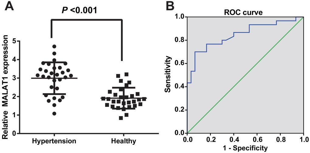 LncRNA MALAT1 was up-regulated in HTN patients. (A) expression of lncRNA MALAT1 in healthy controls and HTN patients; (B) ROC curve represented for the efficiency of lncRNA MALAT1 expression to the diagnosis of HTN patients. n = 30, data were expressed as mean ± standard deviation.