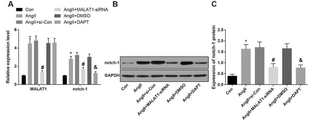 Expression of lncRNA MALAT1 and Notch-1 was elevated in vascular tissues of HTN rats. (A) expression of of lncRNA MALAT1 and Notch-1 in thoracic aorta vascular tissues detected by RT-qPCR; (B) protein band of Notch-1 in thoracic aorta vascular tissues; (C) expression of Notch-1 in thoracic aorta vascular tissues detected by western blot analysis; * P vs the Con group; # P vs the AngII + si-Con group; & P vs the AngII + DMSO group; n = 10, data were expressed as mean ± standard deviation; one-way ANOVA was used for analyzing data, pairwise comparison was analyzed by Tukey’s post hoc test.
