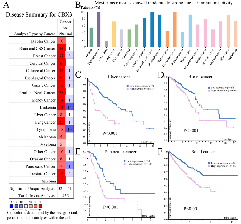 The expression and prognostic significance of CBX3/HP1γ in various cancers. (A) Transcriptional expression of CBX3/HP1γ in 20 different types of cancer (ONCOMINE database). Differences in mRNA expression were compared using Student’s t-tests. The cut-off p value and fold change values were 0.01 and 1.5, respectively, with a gene rank of 10%. (B) CBX3/HP1γ expression in 20 different types of cancer (the Human Protein Atlas database). High CBX3/HP1γ expression was associated with worse prognosis in liver cancer (C), breast cancer (D), pancreatic cancer (E), and renal cancer (F) (Kaplan-Meier Plot, log-rank test, P value 
