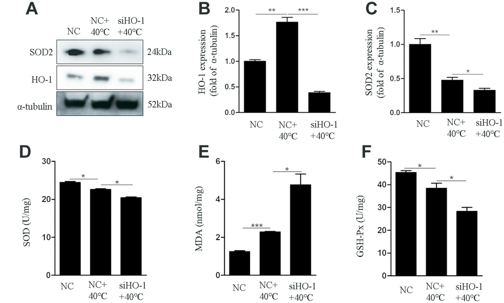 HO-1 gene knockdown impairs antioxidant defenses in GCs exposed to heat stress. GCs were transfected with NC or siHO-1 and exposed to heat stress for 2 h. (A–C) Western blot expression of HO-1 and SOD2. (D) SOD activity. (E) MDA content. (F) GSH-Px activity. Data represent mean ± SEM; n = 3 in each group. *P 