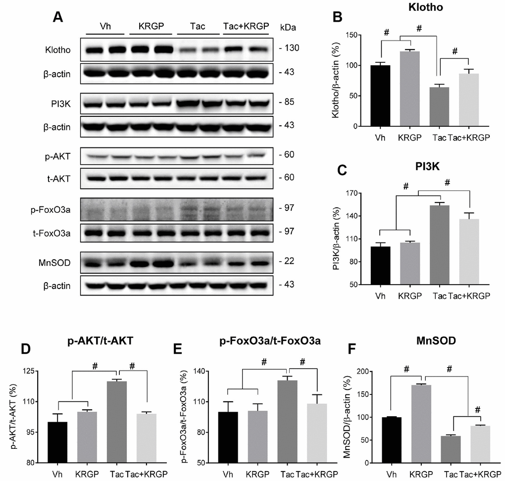 Effect of KRGP administration on Klotho-induced MnSOD signaling pathway in Tac-induced oxidative stress using immunoblot analysis in a mouse model. Representative immunoblot image (A) and its quantification of Klotho (B), PI3K (C), p-AKT/t-AKT (D), p-FoxO3a/t-FoxO3a (E), and MnSOD (F) in the renal cortex. The relative optical densities of bands in each lane were normalized to that of each band of β-actin or total form protein in the same gel. Data are presented as mean ± SE. n = 8. #P 