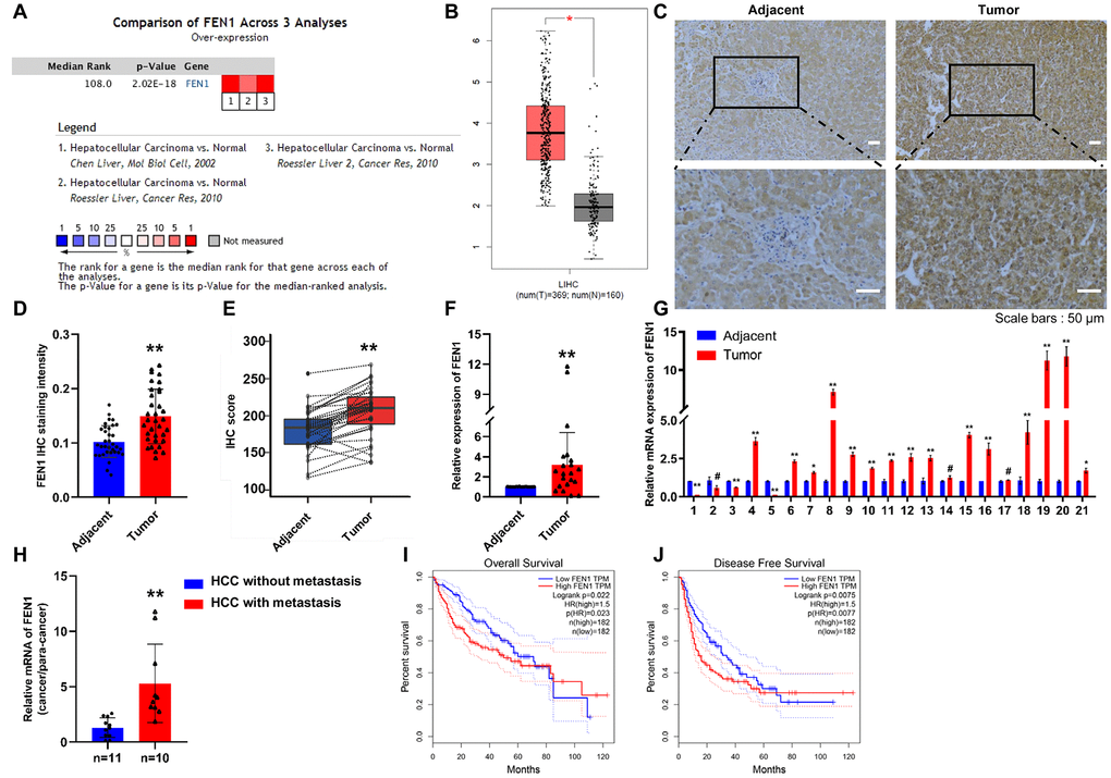 FEN1 is up-regulated in HCC tissues and indicates poor prognosis. (A) FEN1 mRNA expression in HCC among the three studies assessed by ONCOMINE analysis. (B) Elevated expression of FEN1 in HCC tissues compared to normal tissues in the GEPIA database. (C) FEN1 IHC in HCC and para-cancer tissues. (D) Quantification of FEN1 IHC staining; n = 34 per group, **P E) FEN1 IHC score; n = 34 per group, **P F and G) Quantitative RT-qPCR analysis of FEN1 mRNA expression; n = 21 per group, *P P # represents no difference. (H) RT-qPCR analysis of FEN1 mRNA expression, n = 10 for HCC with metastasis and n = 11 for HCC without metastasis, **P I) and disease free survival (J) in the GEPIA database.