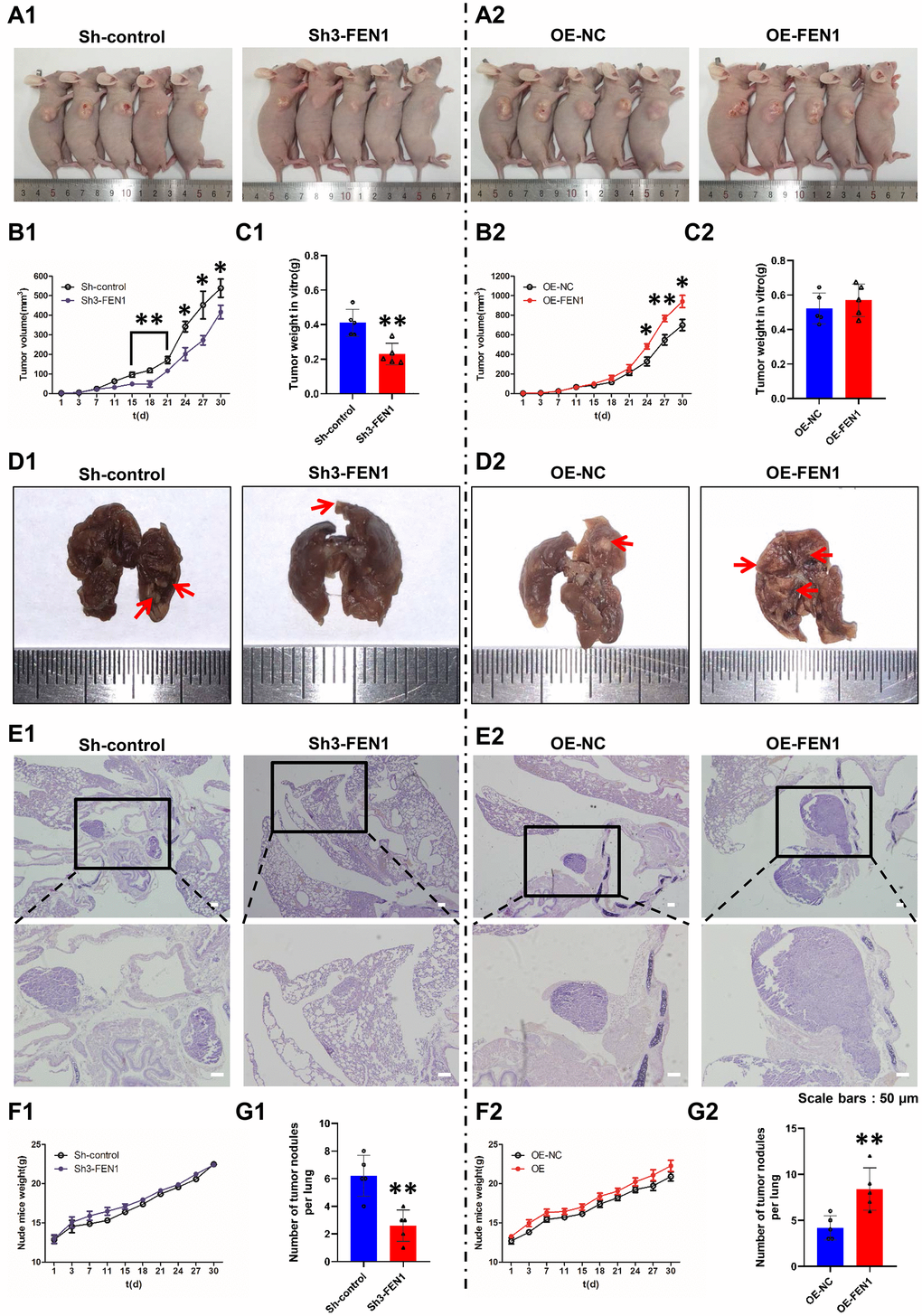 FEN1 promotes tumor growth and lung metastasis in vivo. (A) Images of nude mice bearing subcutaneous tumor xenografts derived either from Sh3-FEN1 (A1) or OE-FEN1 cells (A2). (B1 and B2) Xenograft tumor growth curves; n = 5 per group, *P PC1 and C2) Weights of tumors derived from euthanized nude mice at the endpoint; n = 5 per group, **P D1 and D2) Representative images of lungs with metastatic nodules shown on the surfaces (arrows indicate the nodules) 30 days after injection of cells stably silencing or overexpressing FEN1. (E1 and E2) Representative H & E stained lung tissue sections showing metastatic nodules (arrows); original magnification, 100 x for the upper panels and 200 x for the lower panels. (F1 and F2) Weight growth curves of nude mice, n = 5 per group. (G1 and G2) Number of metastatic nodules on the lung surfaces; data represent mean ± SD, n = 5 per group, **P 