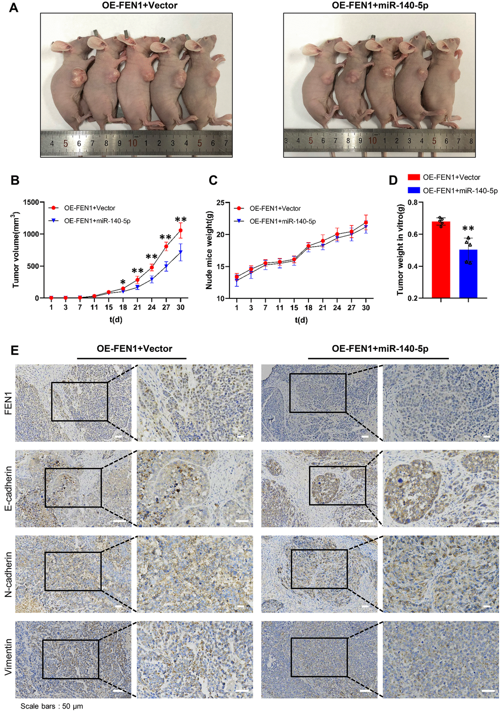 miR-140-5p partially reverses the effect of FEN1 in vivo. (A) Images of nude mice bearing subcutaneous tumor xenografts. (B) Xenograft tumor growth curves; n = 5 per group, *P P C) Weight growth curves of nude mice, n = 5 per group. (D) Weights of tumors derived from euthanized nude mice at the endpoint; n = 5 per group, **P E) IHC staining of FEN1 and EMT markers such as E-cadherin, N-cadherin and vimentin in xenograft tumor tissues; original magnification, 200 x for the upper panels and 400 x for the lower panels in each figure.