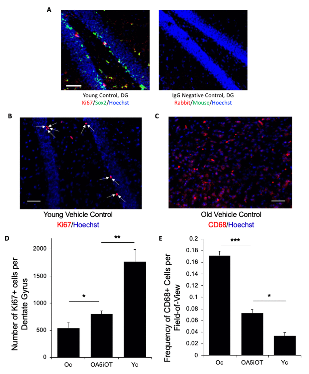 Alk5i+OT treatment improves hippocampal neurogenesis and attenuates inflammation in the brains of old mice. (A) Immunofluorescence was performed on serial 25-micron brain sections with anti-Ki67 (proliferation marker) and anti-Sox-2 (neural stem cell marker), using Hoechst to stain all nuclei. A representative image of ki67 (red)/Sox2 (green)/Hoechst (blue) triple positive cells in the hippocampal Dentate Gyrus of a young control animal treated with HBSS for 7 consecutive days is shown. Scale bar=50 µm. Isotype-matched IgG negative controls exhibited minimal background fluorescence. (B) Immunofluorescence was performed on serial 25-micron brain sections with anti-Ki67 (proliferation marker), using Hoechst to stain all nuclei, imaging the cells in the SGZ of the hippocampal Dentate Gyrus. Representative images of Ki67 (red)//Hoechst (blue) positive cells in the hippocampal Dentate Gyrus. Arrows point to these double-positive cells. Scale bar=50 µm. (C) Immunofluorescence was performed on serial 25-micron brain sections with anti-CD68 (monocyte/microglia marker), using Hoechst to stain all nuclei. Representative images of CD68 (red)/Hoechst (blue) double positive cells. Scale bar=50 µm. (D) The numbers of Ki67+/Hoechst+ cells in the SGZ of DG were quantified through entire hippocampi of each cohort and were found to decline with age as expected, and to increase in the Alk5i+OT old cohort, as compared to the control vehicle-treated old cohort. Young control (Yc n=5), old control (Oc n=5), Alk5i+OT (OA5iOT n=6) *p Oc & OA5iOT = 0.043, **p Yc & OA5iOT = 0.00159, mean and SE are shown. (E) The number of CD68+ brain cells were quantified in all cohorts and were found to increase with age and to decline in Alk5i+OT-treated old muscle, as compared to the vehicle-treated old control. N young control (Yc n=5), old control (Oc n=5), Alk5i+OT (OA5iOT n=6). ***p
