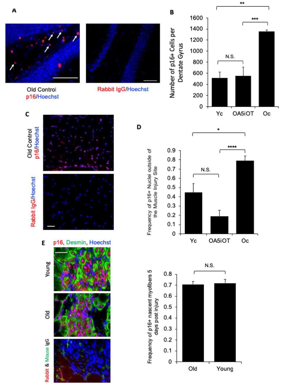 p16 levels are decreased in situ in muscle and brain by Alk5i+OT. Cryosections of injured and uninjured muscle (10 µm, each) and brain (25 µm) were assayed for the number of p16+ nuclei by immunofluorescence, using Hoechst to label all nuclei. p16 showed the predicted nuclear localization in these assays. (A) Representative images of p16+ cells in the polymorphic layer near the dentate gyrus in an old control brain and isotype-matched IgG non-specific immunofluorescence are shown. Arrows point to p16+ (red)/Hoechst+ (blue) nuclei in the stated region. (B) The number of p16+ cells in the polymorphic layer of the hippocampus was decreased by the Alk5i+OT treatment, ***old control & Alk5i+OT p=0.0003, scale bar=50 µm at 40x magnification, IgG scale bar=50 µm at 20x magnification. Young control (Yc) n=5, old control (Oc) n=8, Alk5i+OT (OA5iOT) n=8. (C) Representative images of p16+ nuclei outside of the injury site in the TA muscle of an old vehicle control mouse at 5 days post single CTX injection and isotype-matched IgG non- specific immunofluorescence, are shown; scale bar=50 µm at 20x magnification. (D) The number of p16+/Hoechst+ nuclei divided by the total number of nuclei (Hoechst+) per field-of-view at 20x magnification (frequency of p16+ nuclei) was quantified. The frequency of p16+ nuclei outside of injury sites is significantly greater in muscle of old vehicle-treated control mice, as compared to young control and old Alk5i+OT treated. N=5 for each cohort. Young control (Yc), old+Alk5i+OT (OA5iOT), old control (Oc) N.S. = P-value Yc &OA5iOT = 0.064, *** = P-value Yc & Oc = 0.011, **** = P-value OA5iOT & Oc = 0.000064. (E) Representative images of the sites of injury/regeneration of young and old TA muscle from control - HBSS treated mice; 10-micron sections desmin (green), p16 (red) immunofluorescence and isotype-matched IgG control non-specific immune-fluorescence, are shown. Scale bar is 50 micron at 40x magnification. Robust p16+ nuclei are observed in both young and old muscle, and many of these are in centrally-nucleated newly formed desminhigh myofibers. The frequency of p16+ centrally-nucleated myofibers was quantified (right). The relative number of these p16+ fibers were found to be nearly identical in young injured (n=5) and old injured (n=7) muscle. N.S. = P-value Old and Young = 0.7918.
