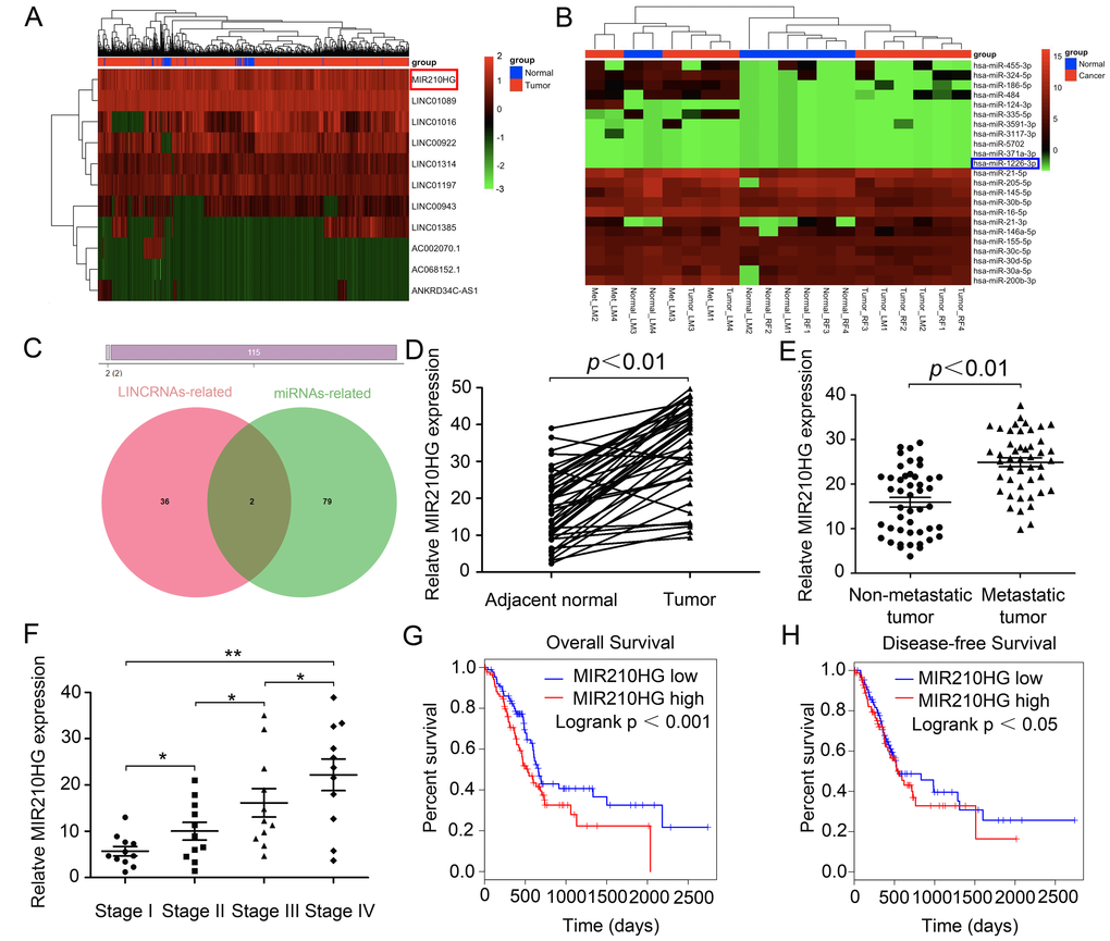 MIR210HG functions as a potential oncogenic lncRNA and confers a poor prognosis in invasive breast cancer patients. (A) lncRNAs microarray data of invasive breast cancer samples compared with that of normal control tissues are presented in a heat map. Red represents high expression, and green represents low expression. MIR210HG (Ensembl: ENSG00000247095) is listed on the right. (B) Heat map of differentially expressed miRNAs from invasive breast cancer miRNA arrays and miRNAs differentially expressed in miRNA arrays. miR-1226-3p (Ensembl: ENSG00000221585) is listed on the right. (C) Venn diagrams showing the number of potential non-coding RNAs targeting metastasis-related genes, as predicted by two databases: miRcode and LncBase Predicted. (D) Real-time PCR assay shown that MIR210HG is significantly up-regulated in 45 paired fresh IBC tissues. (E) Relative expression of MIR210HG in IBC patients with lymph node and distant metastasis. (F) Further analysis indicated that TNM stage was positive correlated with MIR210HG. (G and H) Kaplan-Meier plots of overall-survival (OS) and disease-free survival (DFS) in IBC patients with high and low levels of MIR210HG. *p p 