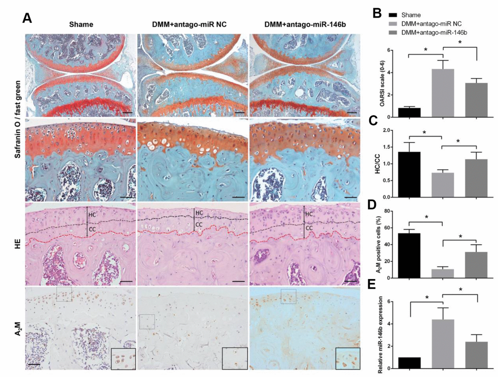 Inhibition of miR-146b in cartilage delays the progression of osteoarthritis in mice. (A) After DMM surgery or sham operation, mice were intra-articularly injected with 250 μM antago-miR-146b or antago-miR NC on day 7 and day 14 after surgery. Knee joints were harvested at 5 weeks after last injection and analysed histologically by Safranin O-fast green staining. (B) OARSI scores based on safranin O and fast green staining in (A). (C) Quantification of HC/CC according to H&E staining in (A). (D) Immunostaining analysis of positive A2M. (E) qRT-PCR analysis of miR-146b levels in mice knee joint cartilage. Scale bar: 100μm (first line); 50μm (others). *P