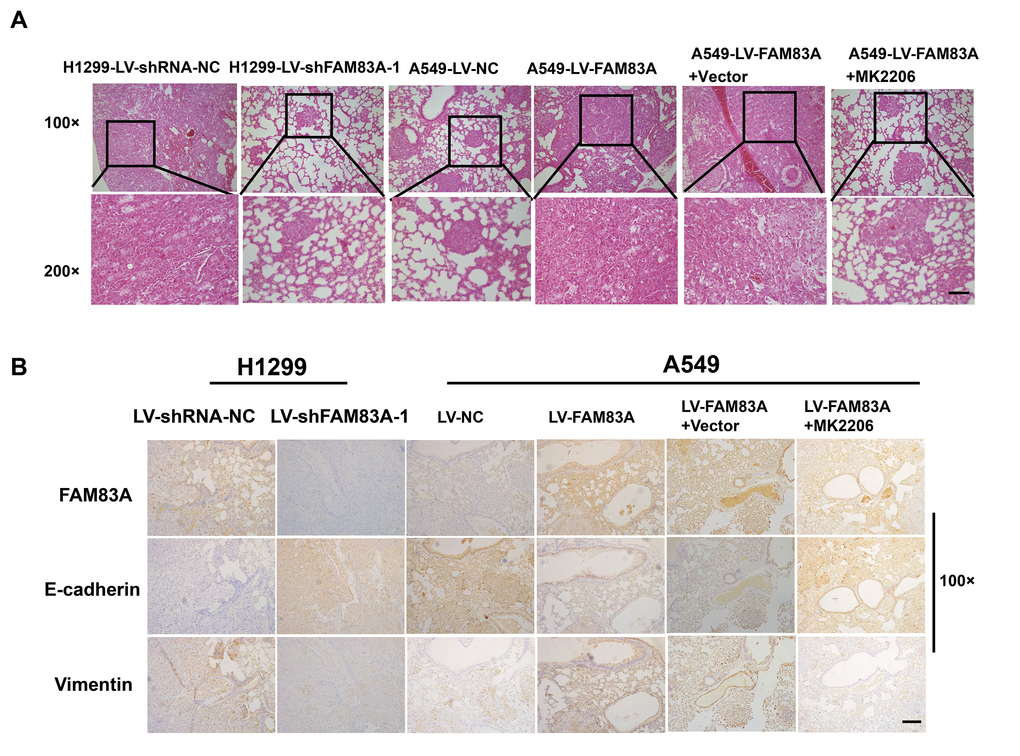 Increased FAM83A expression promoted lung metastasis and EMT in vivo, and AKT inhibitor reduced EMT owing to FAM83A overexpression. (A) HE staining of lung tissues in several groups (A549 and H1299 cells after manipulation of FAM83A expression with or without MK2206) of tumor-bearing mice. (B) Immunohistochemical staining for FAM83A, E-cadherin and Vimentin was performed using serial sections of mouse lung tissues. Scale bar, 100 μm.