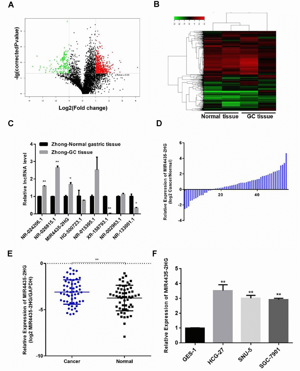 Expression of MIR4435 is up-regulated in GC tissues and cell lines. (A) Volcano plot of lncRNAs illustrating the difference in lncRNA expression between GC tissues and paired normal gastric tissues. The red and green symbols depict significantly up- and down-regulated lncRNAs in GC (P B) Heat map and hierarchical clustering analysis showing the different lncRNA expression profiles in GC and normal samples. The relative expression from high to low level is shown with red and green color. (C, D) Validation of the differential expression of 8 lncRNAs in Zhong cancer tissue and paired normal gastric tissue using RT-qPCR (*P **P E) Detection of MIR4435-2HG expression in 57 GC samples and 57 adjacent normal gastric samples using RT-qPCR. MIR4435-2HG levels were normalized to GAPDH and expressed in terms of the threshold cycle (CT) ratio (**P F) Basal expression of MIR4435-2HG in GES-1, HGC-27, SNU-5, and SGC-7901 cells.