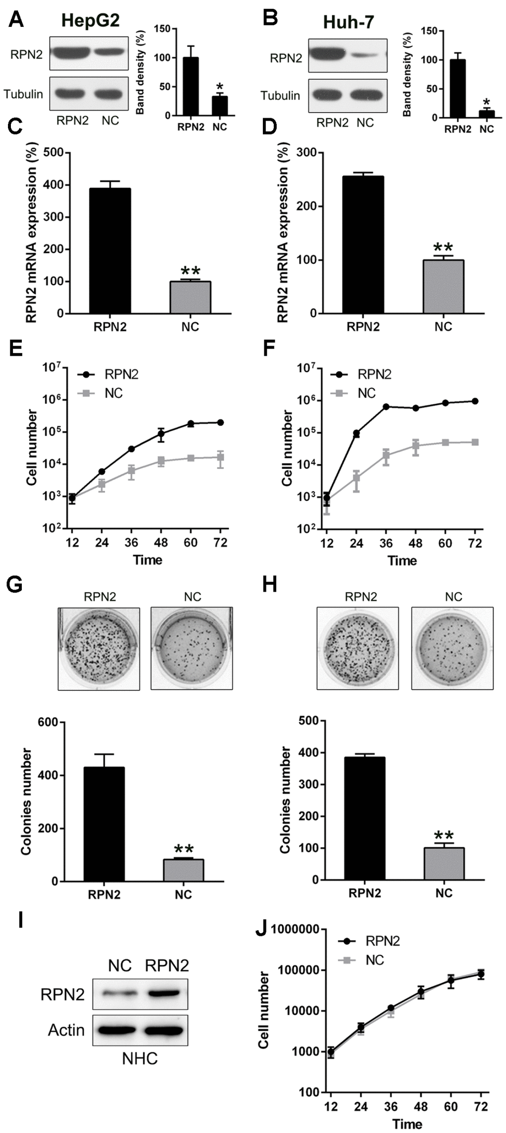 RPN2 overexpression promotes proliferation of Huh-7 and HepG2 cells. The cell lines were transfected with AD-RPN2 and AD-NC (control). Western blotting (A, B) and qPCR (C, D) were conducted to confirm RPN2 overexpression in both the cell lines. (E, F) Multiplication of Huh-7 and HepG2 cells was measured at time points of 12, 24, 36, 48, 60, and 72 h after transfection by the MTT assay. (G, H) Soft agar colony formation assay of the Huh-7 and HepG2 cells expressing RPN2 and controls. (I) The NHC were transfected with AD-RPN2 and AD-NC (control). WB was conducted to confirm RPN2 overexpression in NHC. (J) Multiplication of NHC was measured at time points of 12, 24, 36, 48, 60, and 72 h after transfection by the MTT assay. The band of target protein was normalized to the density of action. The quantification was performed independently in a single band. The experiments were performed three times. Data are recorded as mean ± SD. **P 