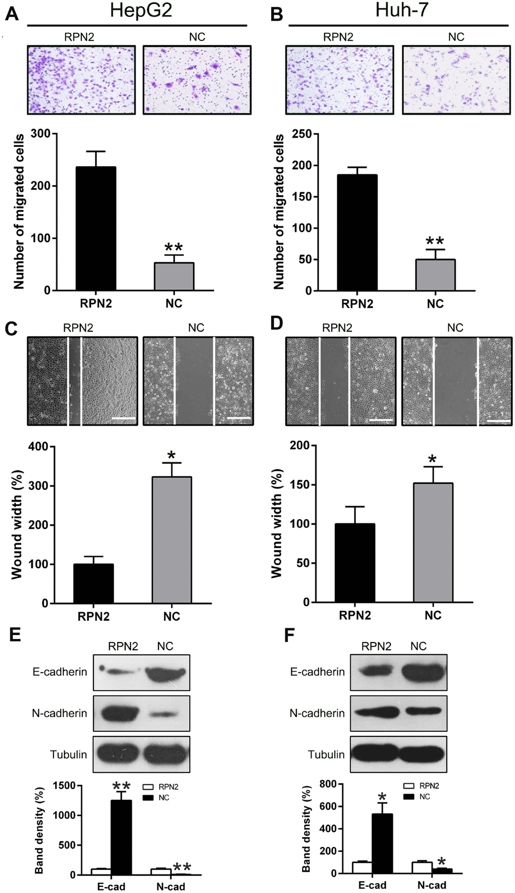 Overexpression of RPN2 suppressed HCC cell migration and invasion. After AD-RPN2 infection, migration and invasive process of HepG2 and Huh-7 cells were examined using injury healing (A, B) and transwell migration assays (C, D). (E, F) WB analysis was performed to examine E-cadherin and N-cadherin expression levels in HCC cells stably expressing RPN2. The band of target protein was normalized to the density of action. The quantification was performed independently in a single band. The experiments were performed three times. Data are recorded as mean ± SD. *P P 
