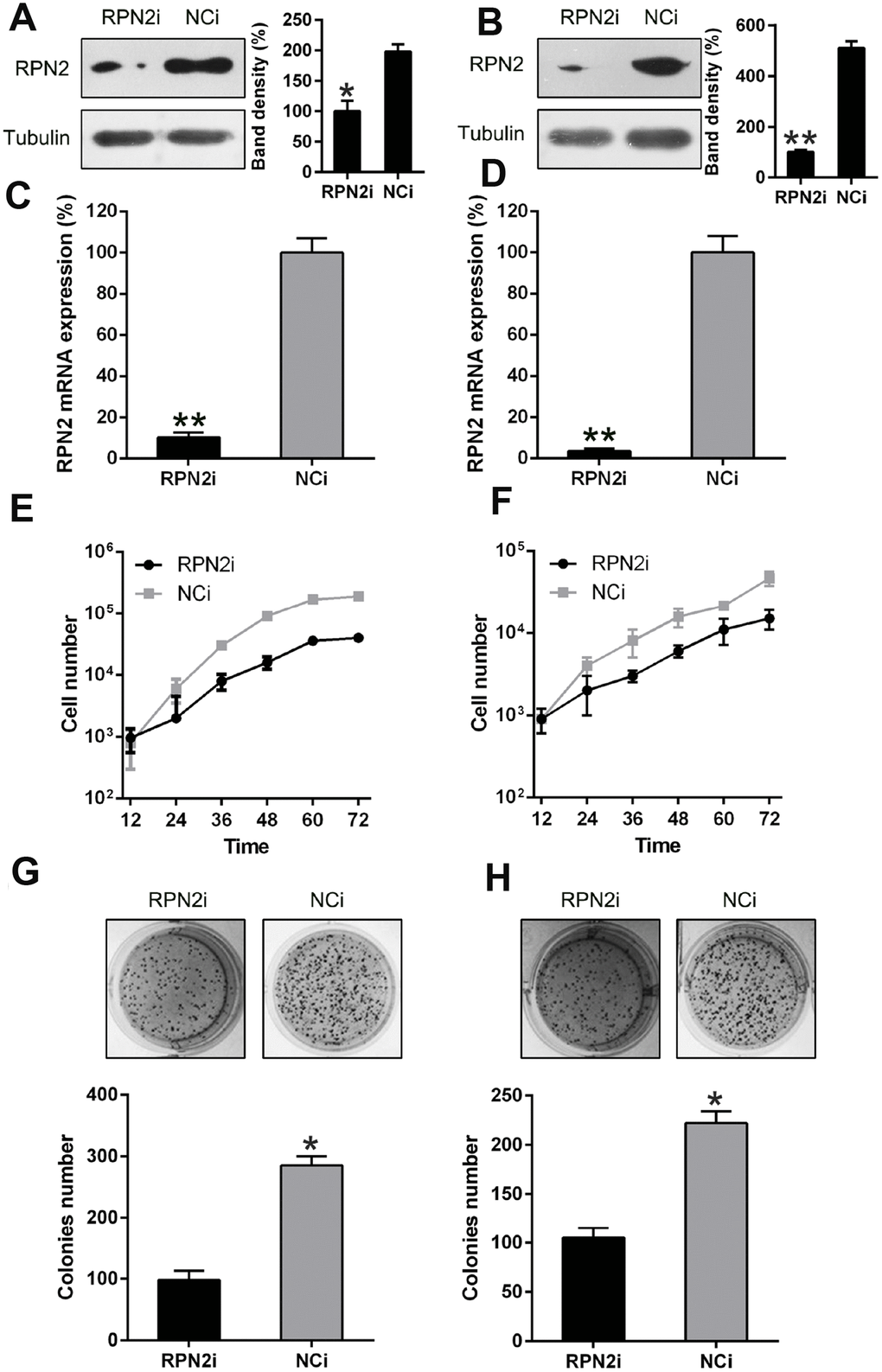RPN2 silencing restrained HCC cell proliferation. Western blotting (A, B) and qPCR (C, D) were conducted to confirm the silencing of RPN2 in both cell lines. (E, F) multiplication rate of Huh-7 and HepG2 cells was measured at the time points of 12, 24, 36, 48, 60, and 72 h after the transfection by using MTT assay. (G, H) Soft agar colony formation test was used to examine the replicative rate of HepG2 and Huh-7 cells transfected with shRNA-RPN2. The band of target protein was normalized to the density of action. The quantification was performed independently in a single band. Data are recorded as mean ± SD. *P P P 