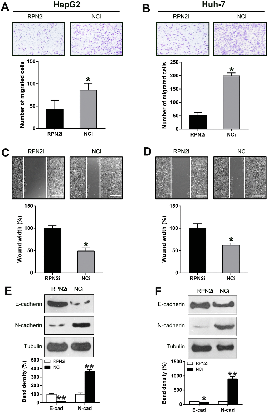 Silencing of RPN2 suppressed HCC cell migration and invasion. After shRNA-RPN2 plasmid transfection, migration and invasive processes of HepG2 and Huh-7 cells were examined using injury healing (A, B) and transwell migration assays (C, D). (E, F) WB analysis detected the protein level of E-cadherin and N-cadherin in HCC cells transfected with shRNA-RPN2. The band of target protein was normalized to the density of action. The quantification was performed independently in a single band. Representative data from three separate experiments were recorded as mean ± SD. *P 
