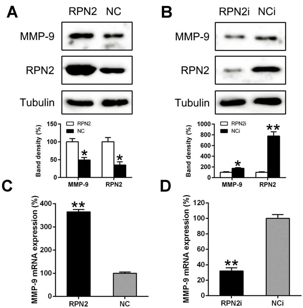 RPN2 regulated the MMP-9 expression level in the HCC cells. HepG2 cells were transfected with AD-RPN2 or shRNA-RPN2. MMP-9 Protein and mRNA expression was detected via the WB (A, B) and qPCR (C, D). The band of target protein was normalized to the density of action. The quantification was performed independently in a single band. The experiments were performed three times. Data are represented as mean ± SD. **P 